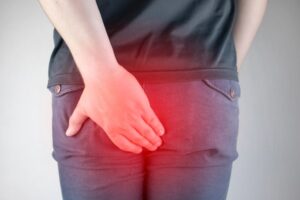 Bowel incontinence and Bowel Cancer